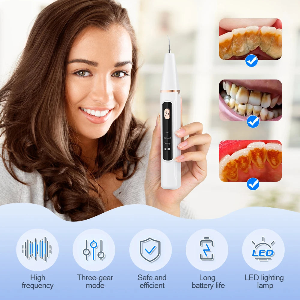 Scaler dentale ad ultrasuoni per denti, rimozione di tartaro, tartaro dentale, pulitore elettrico sonico per denti, rimozione di calcoli dentali